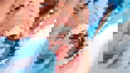 Woman Having Dental Check Up