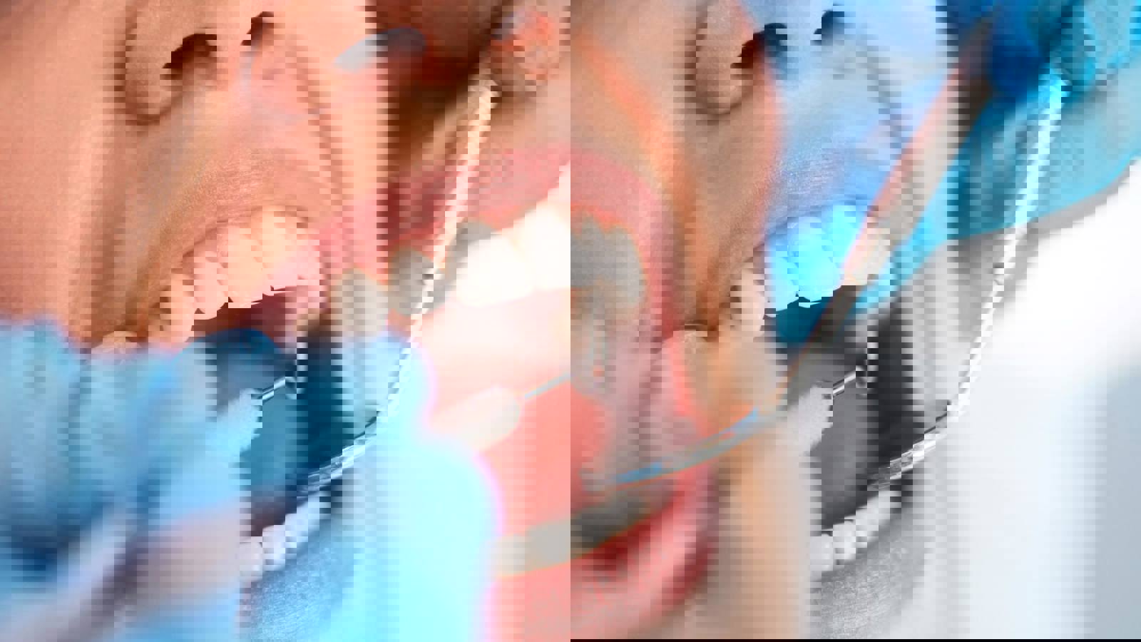 Woman having dental check-up